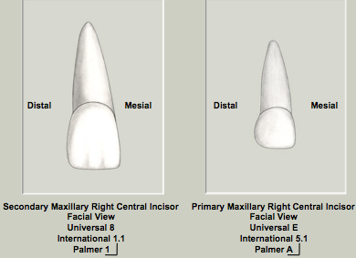 Set Traits Mx Central Incisors.png